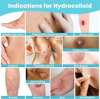 Hydrocolloid Healing Protection Roll Tape