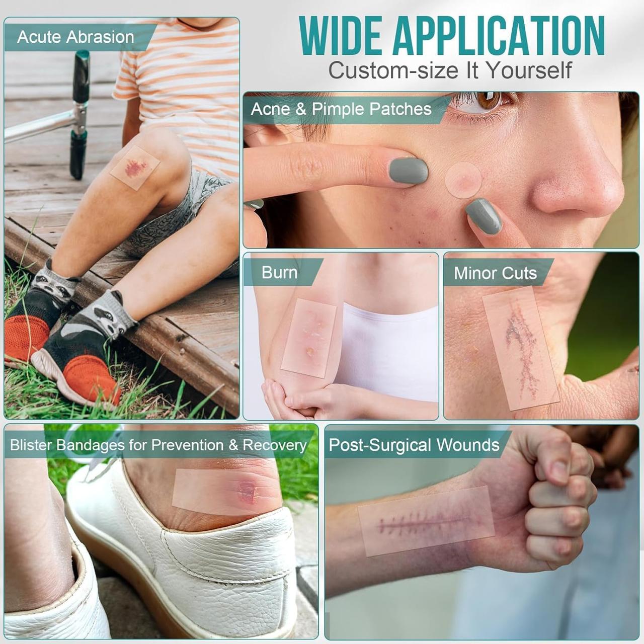 Hydrocolloid Healing Protection Roll Tape