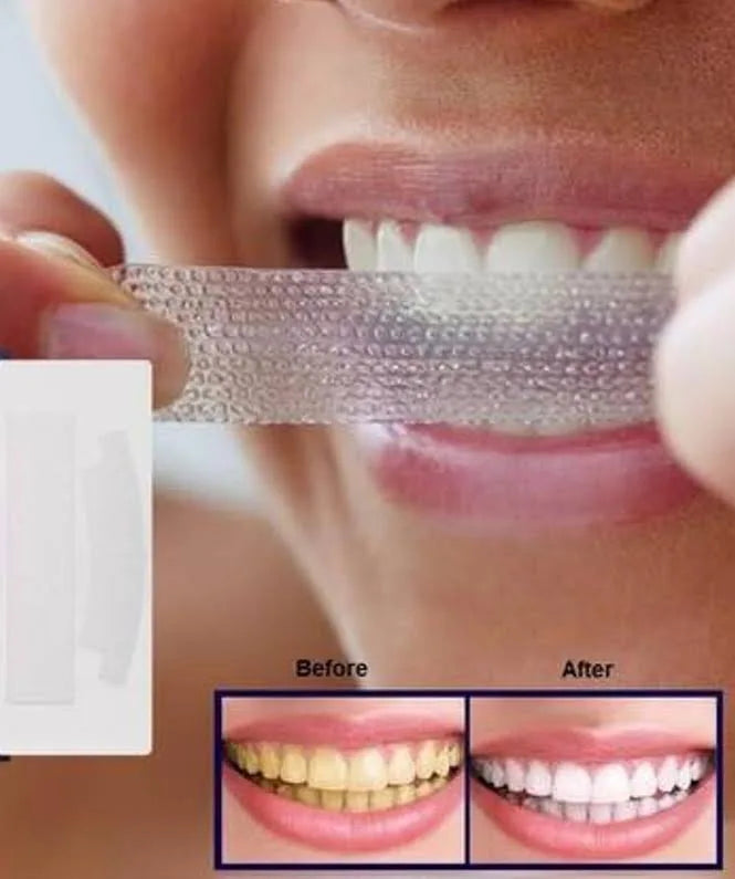 Teeth whitening strips