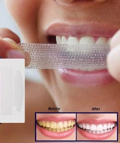 Teeth whitening strips
