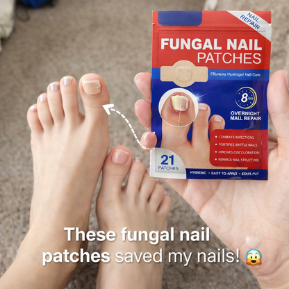 Nail Treatment Fungal Nail Patches (Pack of 1 )