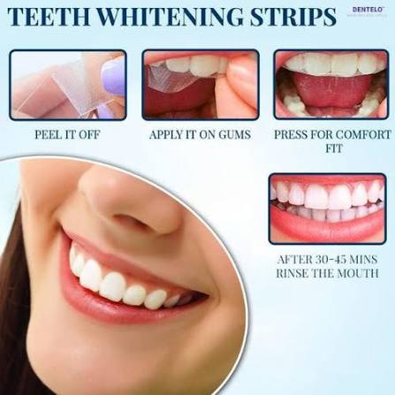 Teeth whitening strips