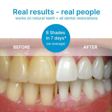 Teeth whitening strips